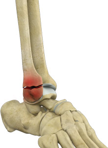 Foot and Ankle Anatomy