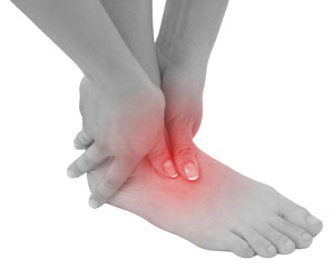 Ankle Sprains