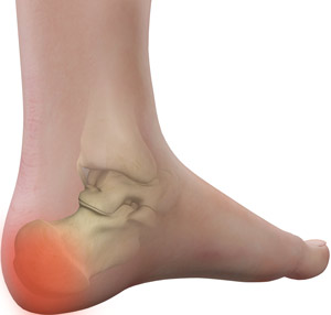 back of foot bone pain