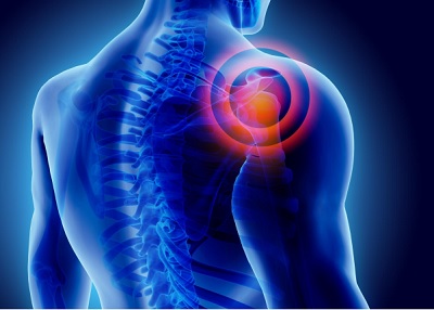 Shoulder Injury? 5 Causes of Shoulder Pain