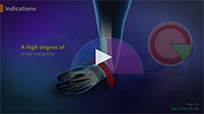Ankle Instability Surgery