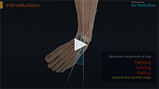 Ankle Sprain