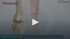 High Tibial Osteotomy