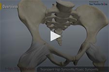 Hip Synovitis