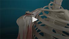 Shoulder Joint Replacement